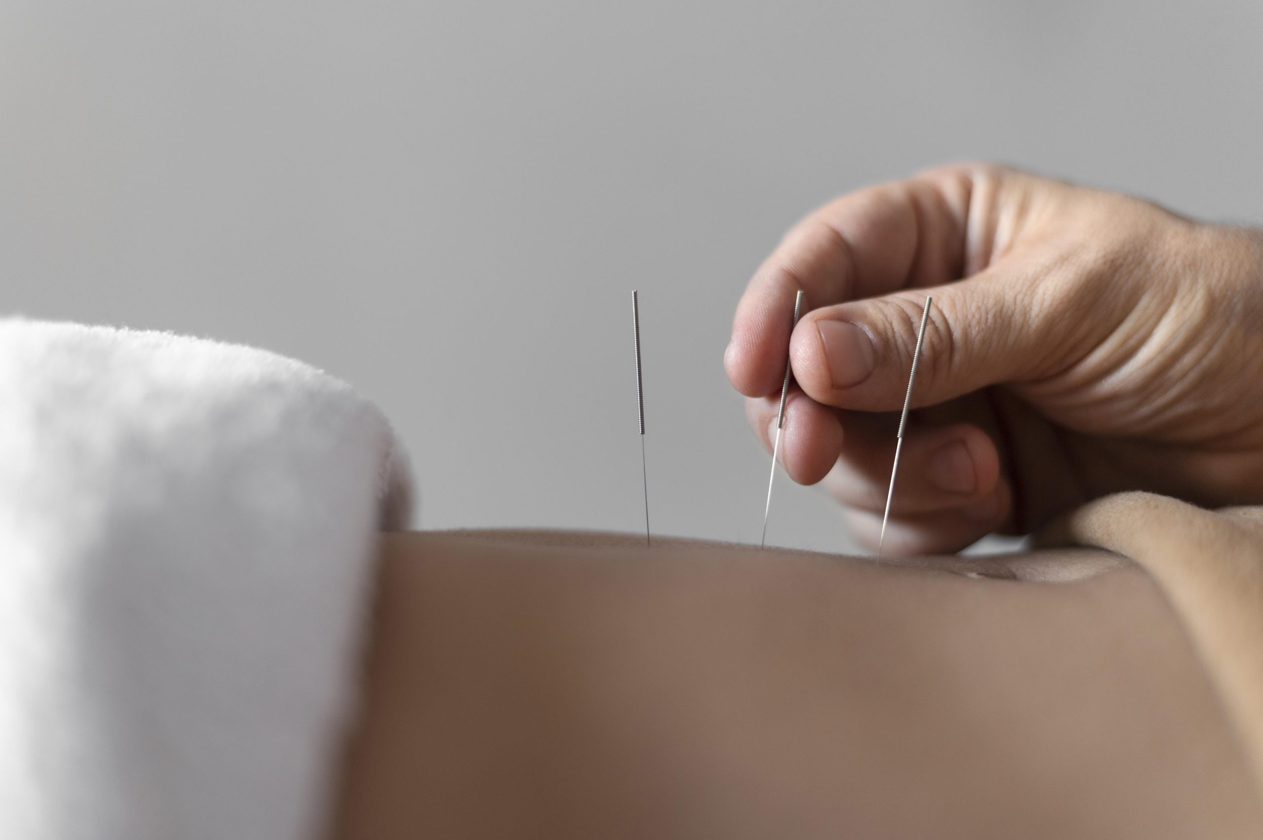 Computer screen displaying brand design elements for acupuncture marketing services