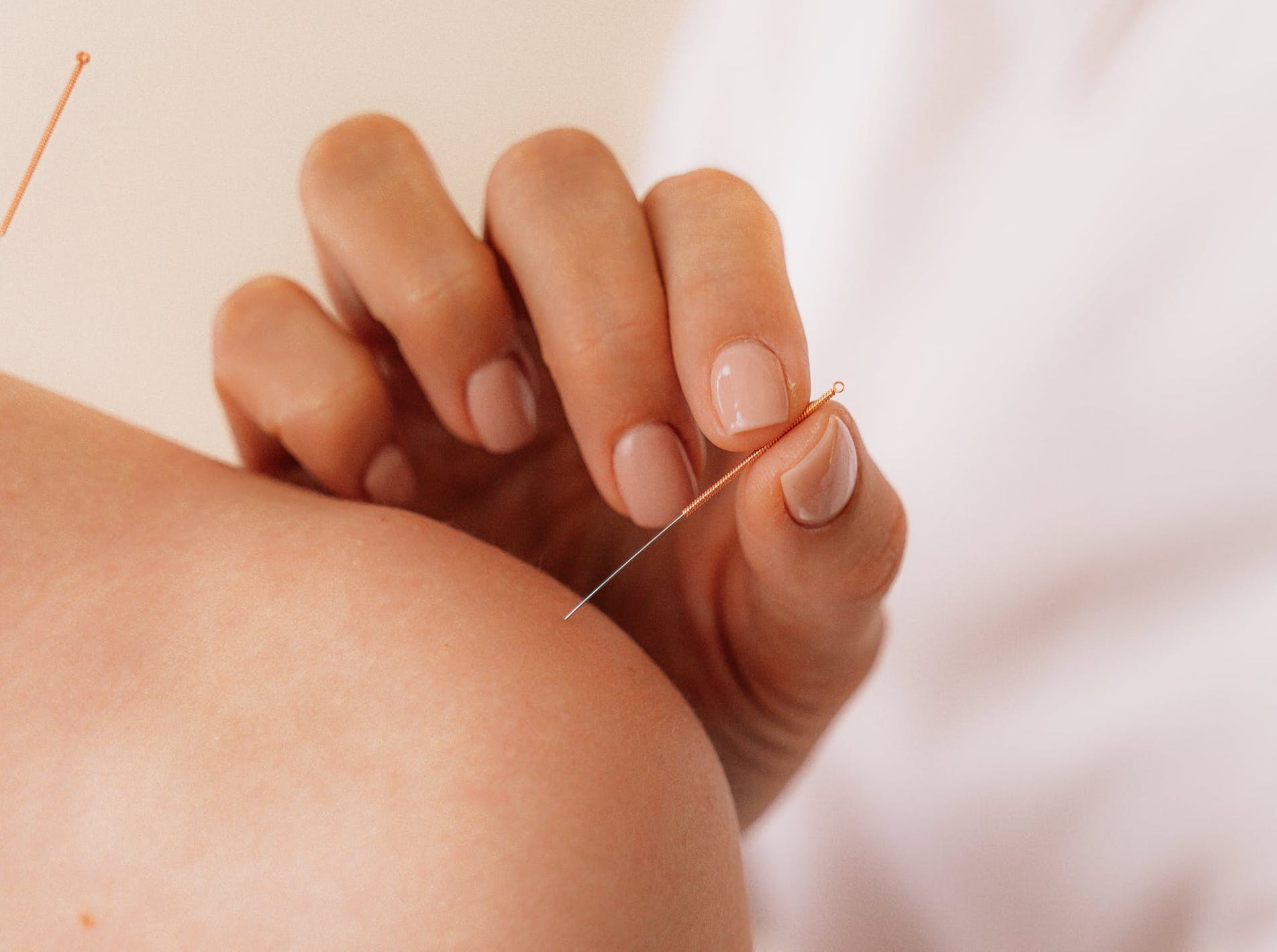 Building an ethical email list in an acupuncture clinic