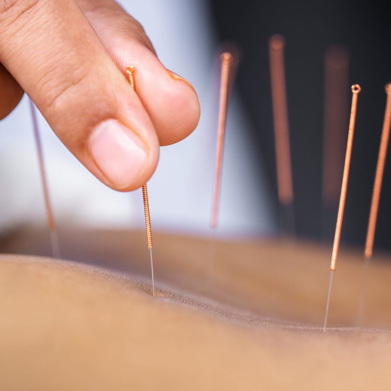 Example of well-written Google Ads for acupuncture clinic