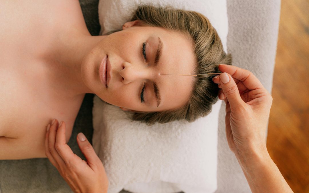 Successful acupuncture marketing strategies