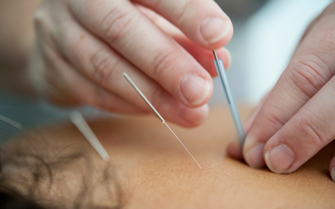 Montage of effective marketing strategies for acupuncture clinics.