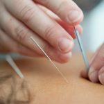 Montage of effective marketing strategies for acupuncture clinics.