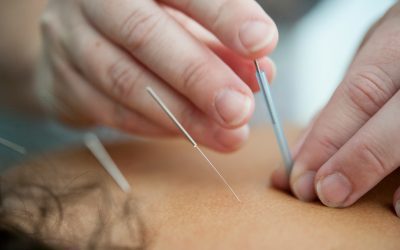 How Much Should You Spend on Acupuncture Marketing? Budgeting Guidelines for Clinics
