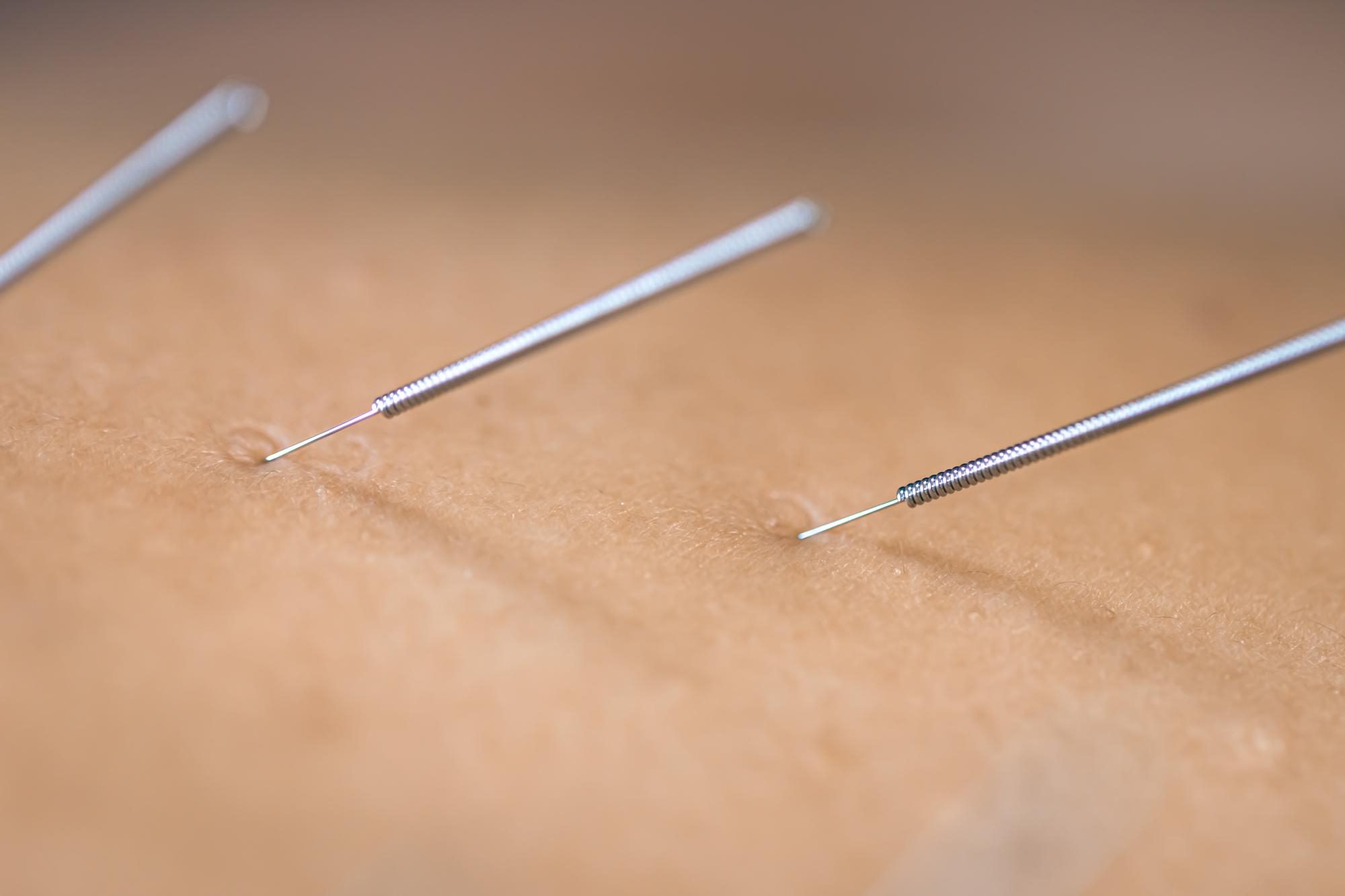 Acupuncture marketing mistakes - inconsistent branding