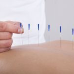 A strong and clear unique value proposition for an acupuncture clinic.