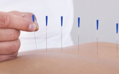 Building an Acupuncture Marketing Plan for 2025: Detailed Guide