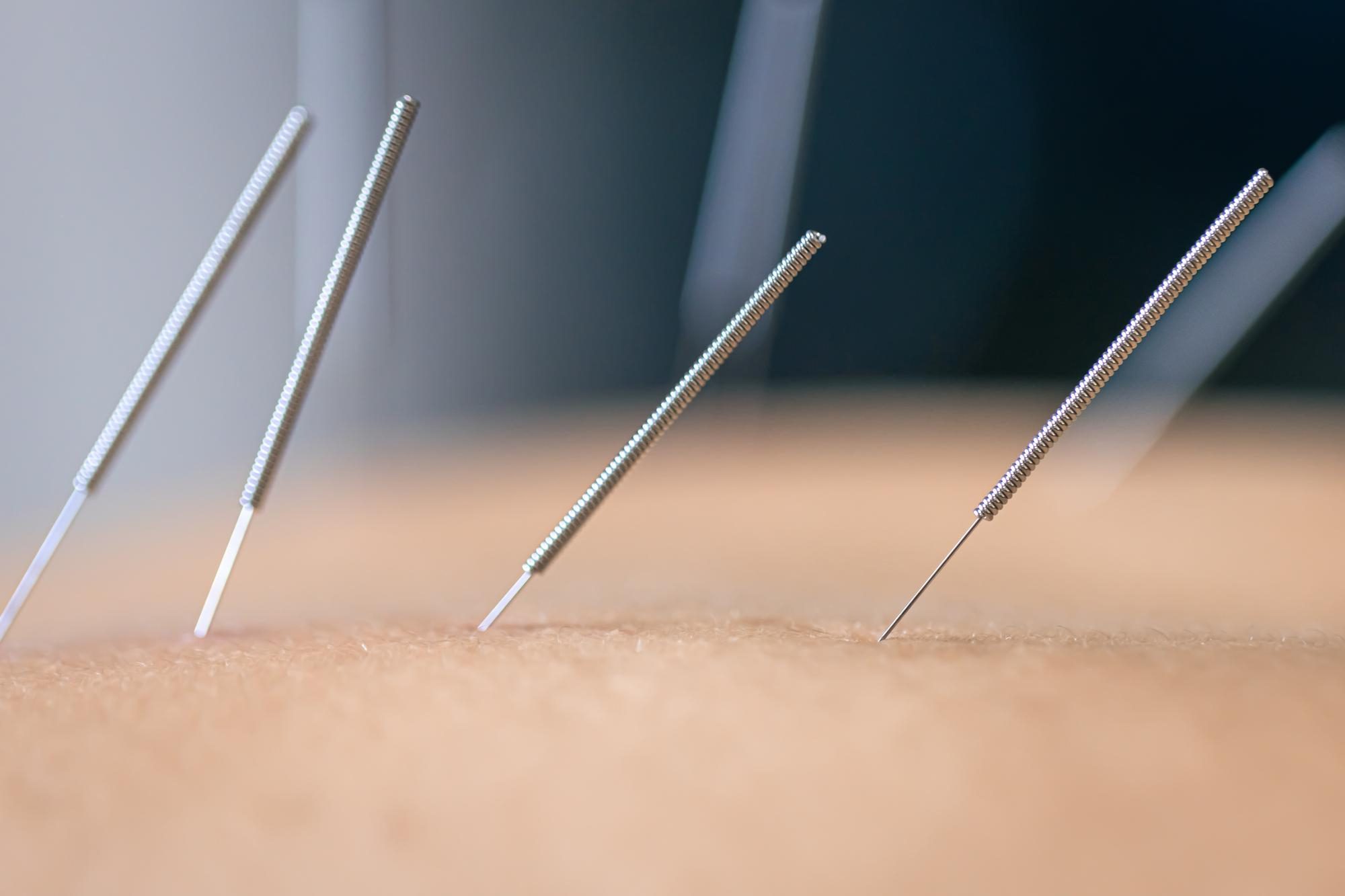 Acupuncturist creating short-form video content for Instagram and TikTok