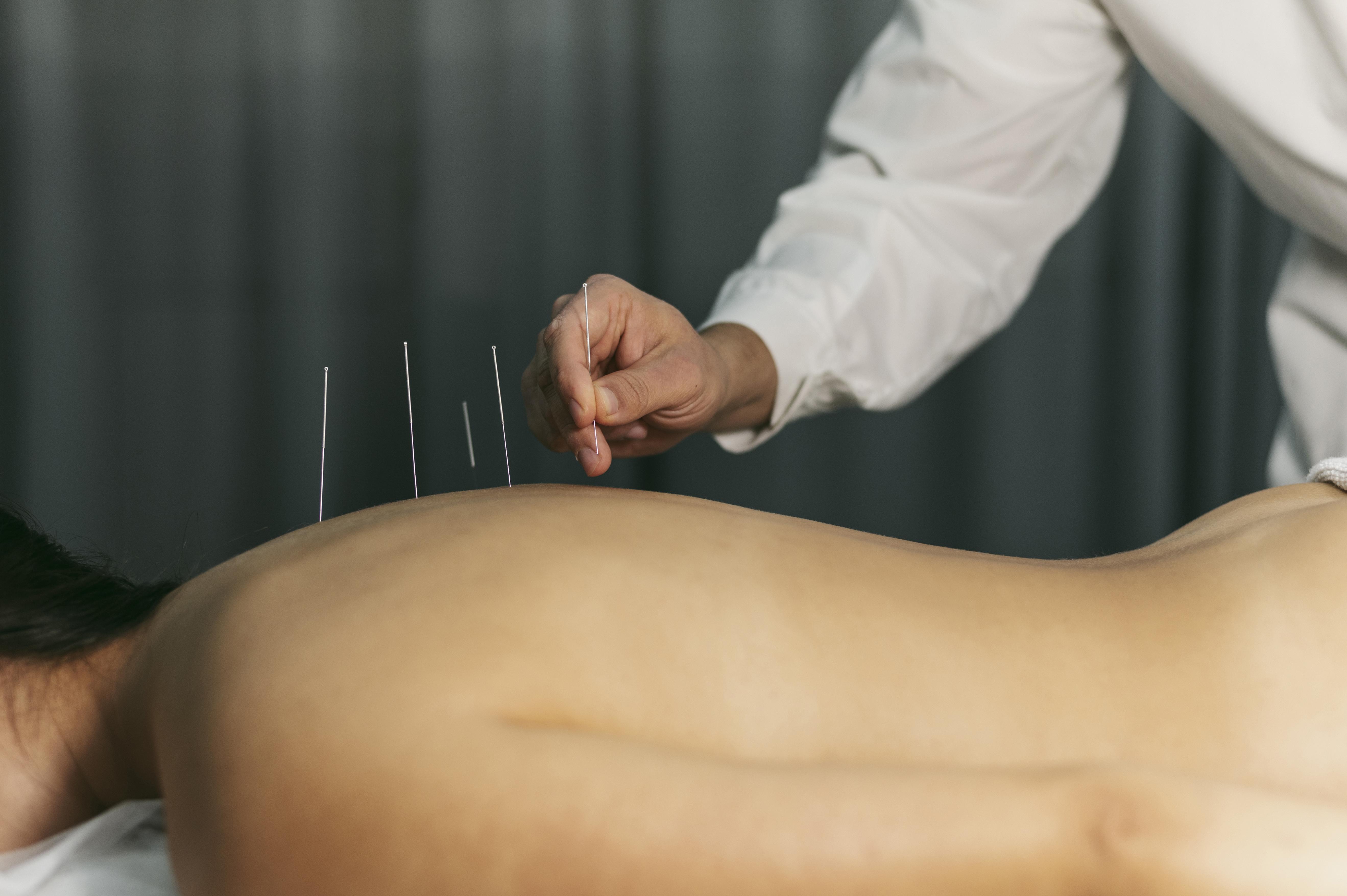 Overview of acupuncture practice management tools for non-tech acupuncturists