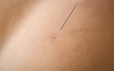 7 Must-Have Features for an Effective Acupuncture Website