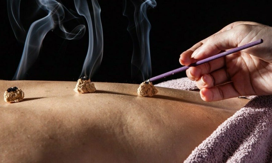 Acupuncture business growth through promotion strategies
