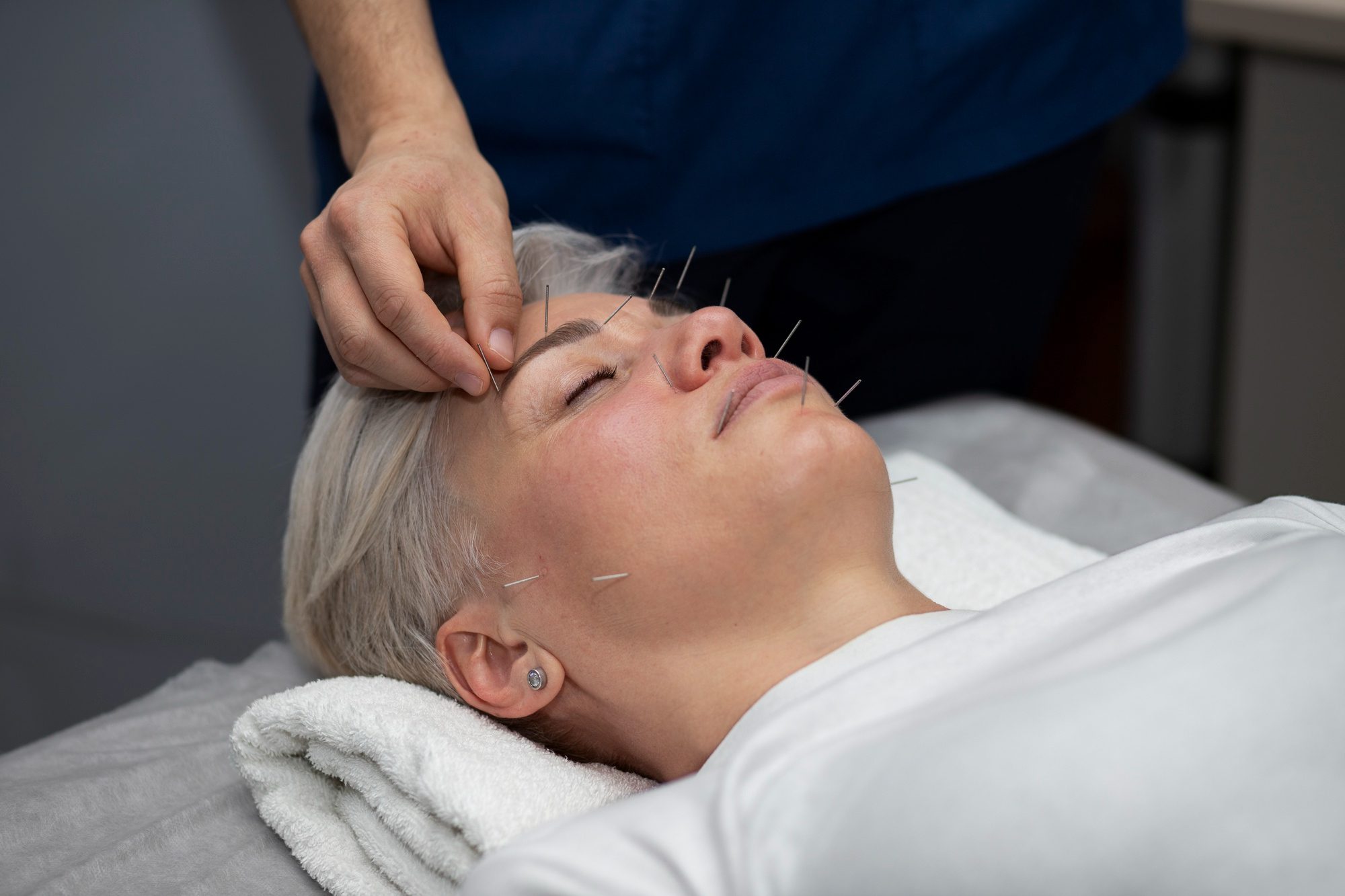 Acupuncturist sharing tips on Instagram